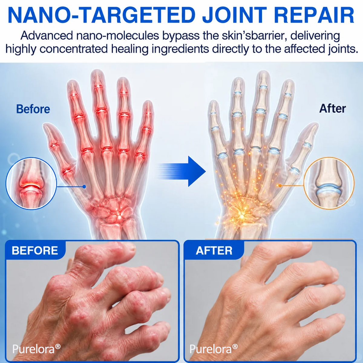 🪐Purelora® Advanced Microneedle Joint Patch Support Comfortable Movement & Daily Joint Care — Without Pills, Creams, Or Complicated Routines.