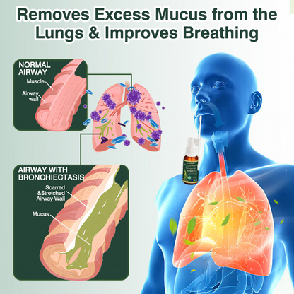 ✅ Official Australian Flagship Store: Curalona® Mullein Leaf Extract Lung-Cleansing Spray (👨‍⚕️ Targets COPD, asthma, chronic bronchitis, respiratory infections, lung cancer, sinusitis, and other lung-related conditions)