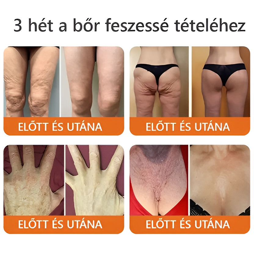 ✨ ZödVita® Méhméreg Bőr Helyreállító Krém 🔥 Természetes Öregedésgátló, Feszesíti a Bőrt, Csökkenti a Ráncokat– 50ml