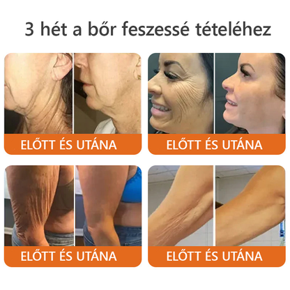✨ ZödVita® Méhméreg Bőr Helyreállító Krém 🔥 Természetes Öregedésgátló, Feszesíti a Bőrt, Csökkenti a Ráncokat– 50ml
