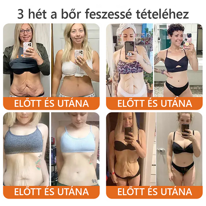✨ ZödVita® Méhméreg Bőr Helyreállító Krém 🔥 Természetes Öregedésgátló, Feszesíti a Bőrt, Csökkenti a Ráncokat– 50ml