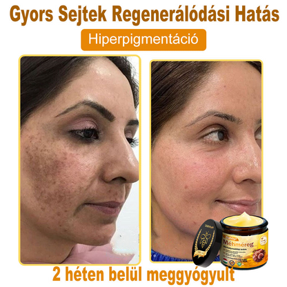 ✨ ZödVita® Méhméreg Bőr Helyreállító Krém 🔥 Természetes Öregedésgátló, Feszesíti a Bőrt, Csökkenti a Ráncokat– 50ml