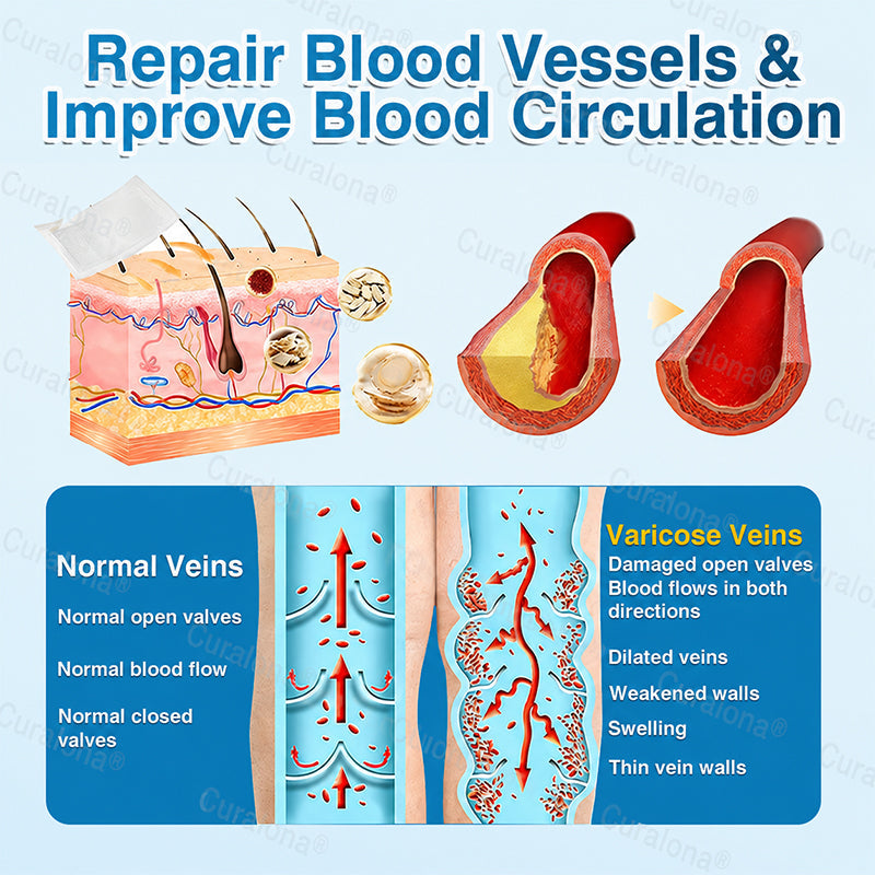 🇬🇧👨‍⚕️✅💙Curalona® VeinRepair Microneedle Patch Roll⚡Instant Relief, Long-Term Results