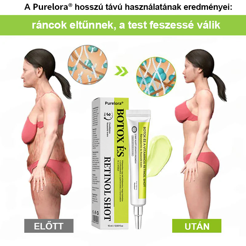 [🔥Utolsó nap 70% kedvezmény] Purelora® Botox és Retinol injekció - Radír mély ráncokra, megereszkedett toka és duzzadt szemek ellen