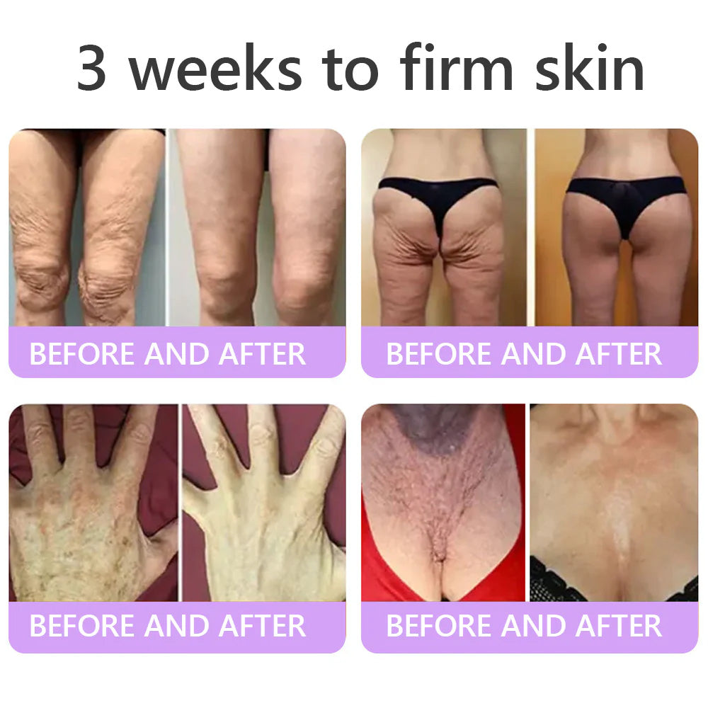 Purelora® 🍅PDRN Multi-Peptide Massaging Body Roller Cream- Anti-aging, Hydrating, Skin Firming & Lifting, Skin Repair, Even Tone, Acne and Dark Spot Treatment, Wart and Mole Removal, and Psoriasis Relief.