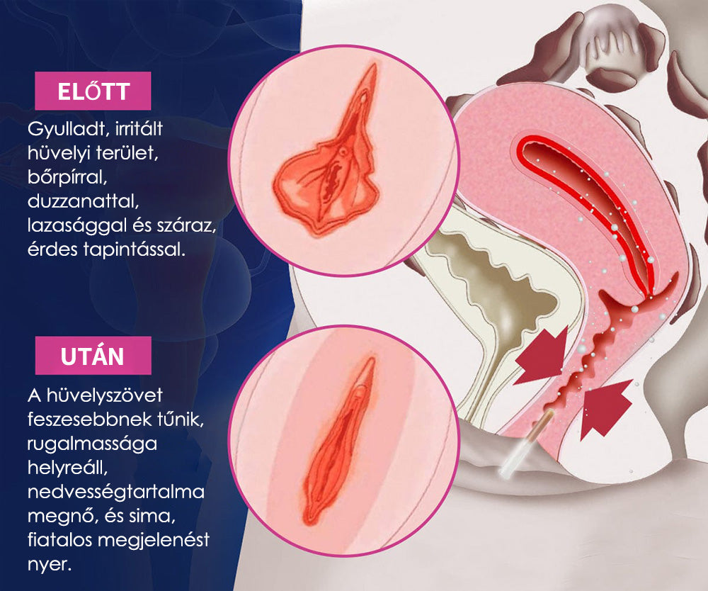 Curalona® Azonnali viszketéscsillapító és méregtelenítő, karcsúsító és feszesítő bőrregeneráló, rózsaszín és gyengéd természetes kapszulák PRO