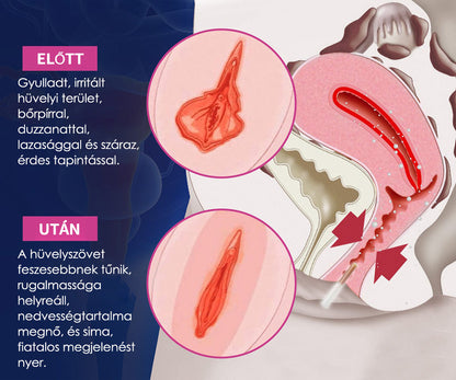 Curalona® Azonnali viszketéscsillapító és méregtelenítő, karcsúsító és feszesítő bőrregeneráló, rózsaszín és gyengéd természetes kapszulák PRO