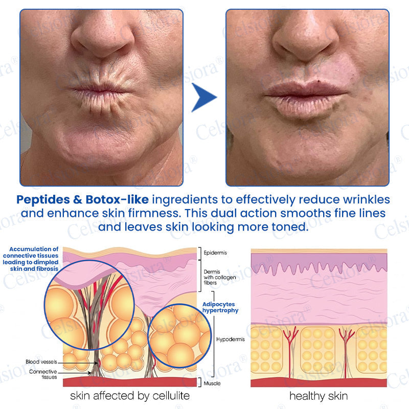 🥈🧡🧶Curalona® Botox & PDRN Anti-Wrinkle Shot – Lift & Firming Cream