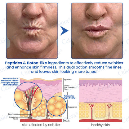 🥈🧡🧶Curalona® Botox & PDRN Anti-Wrinkle Shot – Lift & Firming Cream