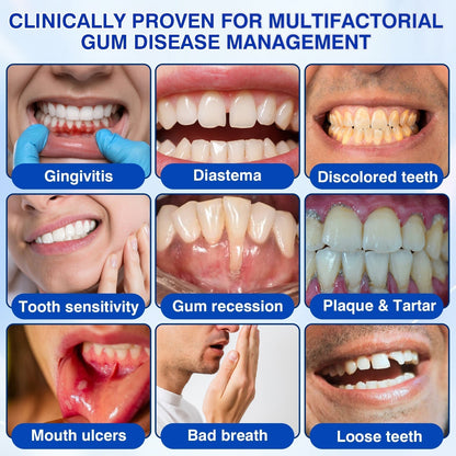 🇦🇺🦷Curalona® GumRevive Periodontal Repair Gel (For Bleeding Gums, Gum Recession & Loose Teeth)+ 🎁 FREE Gum Care Kit