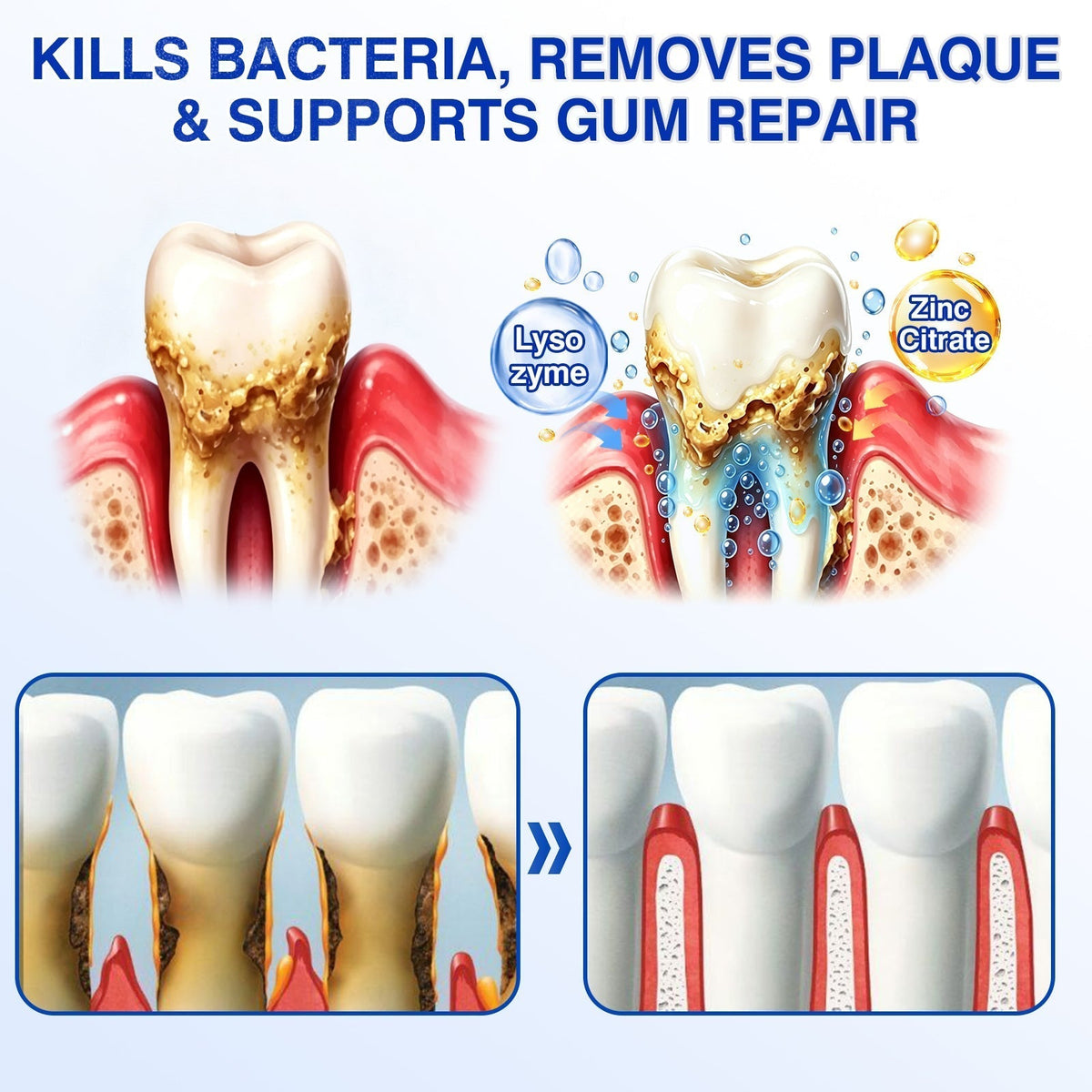 🇦🇺🦷Curalona® GumRevive Periodontal Repair Gel (For Bleeding Gums, Gum Recession & Loose Teeth)+ 🎁 FREE Gum Care Kit