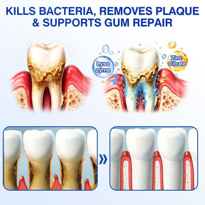 🇦🇺🦷Curalona® GumRevive Periodontal Repair Gel (For Bleeding Gums, Gum Recession & Loose Teeth)+ 🎁 FREE Gum Care Kit