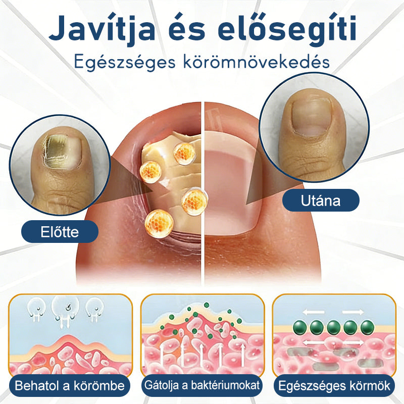 Purelora®Bioaktív Mélyen Behatoló Rendszer Körömgomba Ellen