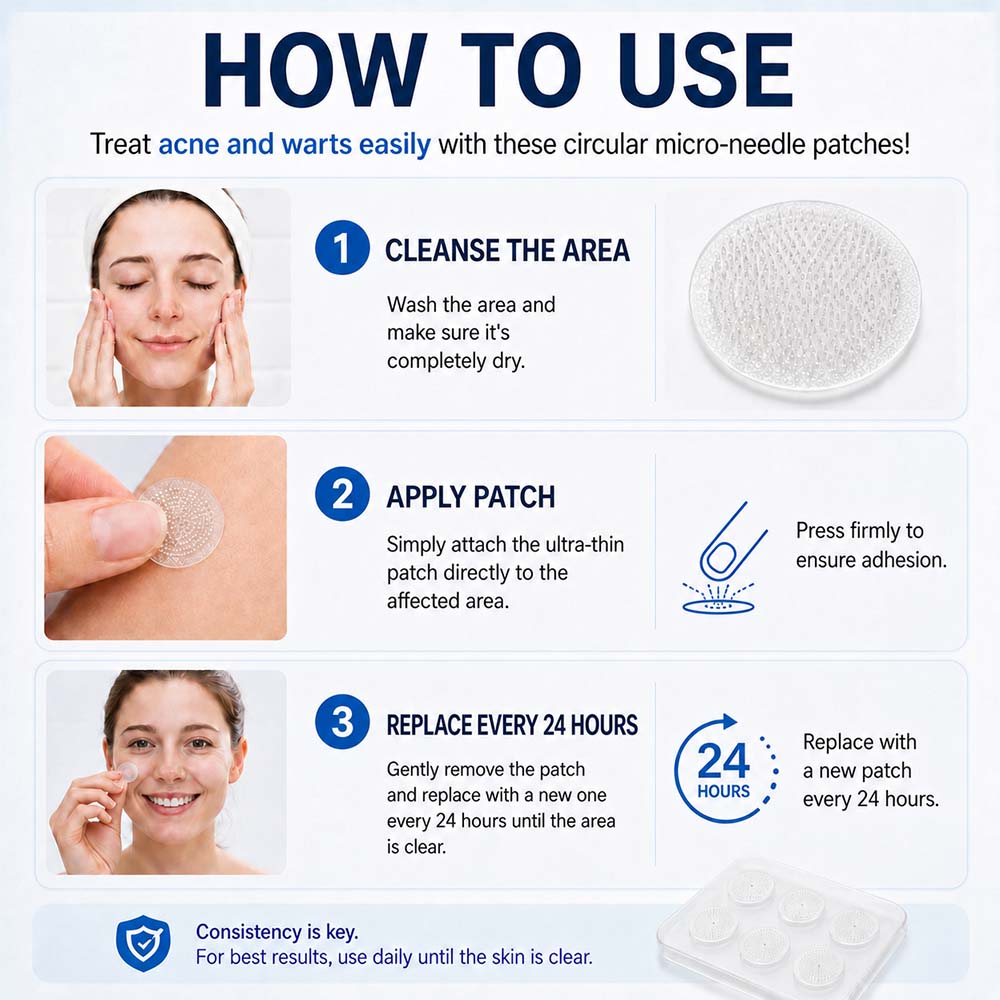 👩‍⚕️🍃 𝐎𝐟𝐟𝐢𝐜𝐢𝐚𝐥 𝐒𝐭𝐨𝐫𝐞 | Curalona® 🌿 𝐁𝐨𝐭𝐚𝐧𝐢𝐜𝐚𝐥 𝐌𝐢𝐜𝐫𝐨𝐧𝐞𝐞𝐝𝐥𝐞 𝐇𝐲𝐝𝐫𝐨𝐜𝐨𝐥𝐥𝐨𝐢𝐝 𝐏𝐚𝐭𝐜𝐡 (𝐅𝐨𝐫 𝐒𝐤𝐢𝐧 𝐓𝐚𝐠𝐬, 𝐒𝐦𝐚𝐥𝐥 𝐒𝐤𝐢𝐧 𝐆𝐫𝐨𝐰𝐭𝐡𝐬, 𝐖𝐚𝐫𝐭𝐬, 𝐌𝐨𝐥𝐞𝐬, 𝐀𝐠𝐞 𝐒𝐩𝐨𝐭𝐬 & 𝐏𝐢𝐠𝐦𝐞𝐧𝐭𝐚𝐭𝐢𝐨𝐧 𝐂𝐨𝐧𝐜𝐞𝐫𝐧𝐬)