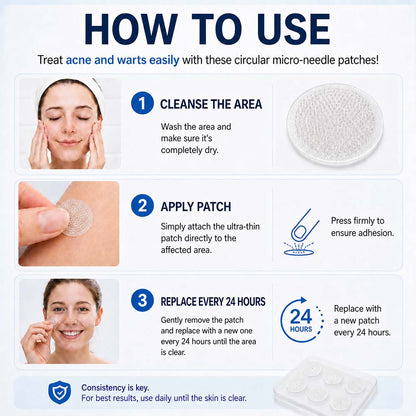 👩‍⚕️🍃 𝐎𝐟𝐟𝐢𝐜𝐢𝐚𝐥 𝐒𝐭𝐨𝐫𝐞 | Curalona® 🌿 𝐁𝐨𝐭𝐚𝐧𝐢𝐜𝐚𝐥 𝐌𝐢𝐜𝐫𝐨𝐧𝐞𝐞𝐝𝐥𝐞 𝐇𝐲𝐝𝐫𝐨𝐜𝐨𝐥𝐥𝐨𝐢𝐝 𝐏𝐚𝐭𝐜𝐡 (𝐅𝐨𝐫 𝐒𝐤𝐢𝐧 𝐓𝐚𝐠𝐬, 𝐒𝐦𝐚𝐥𝐥 𝐒𝐤𝐢𝐧 𝐆𝐫𝐨𝐰𝐭𝐡𝐬, 𝐖𝐚𝐫𝐭𝐬, 𝐌𝐨𝐥𝐞𝐬, 𝐀𝐠𝐞 𝐒𝐩𝐨𝐭𝐬 & 𝐏𝐢𝐠𝐦𝐞𝐧𝐭𝐚𝐭𝐢𝐨𝐧 𝐂𝐨𝐧𝐜𝐞𝐫𝐧𝐬)