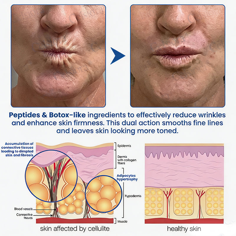 🥈🧡🧶Curalona® Botox & PDRN Anti-Wrinkle Shot – Lift & Firming Cream