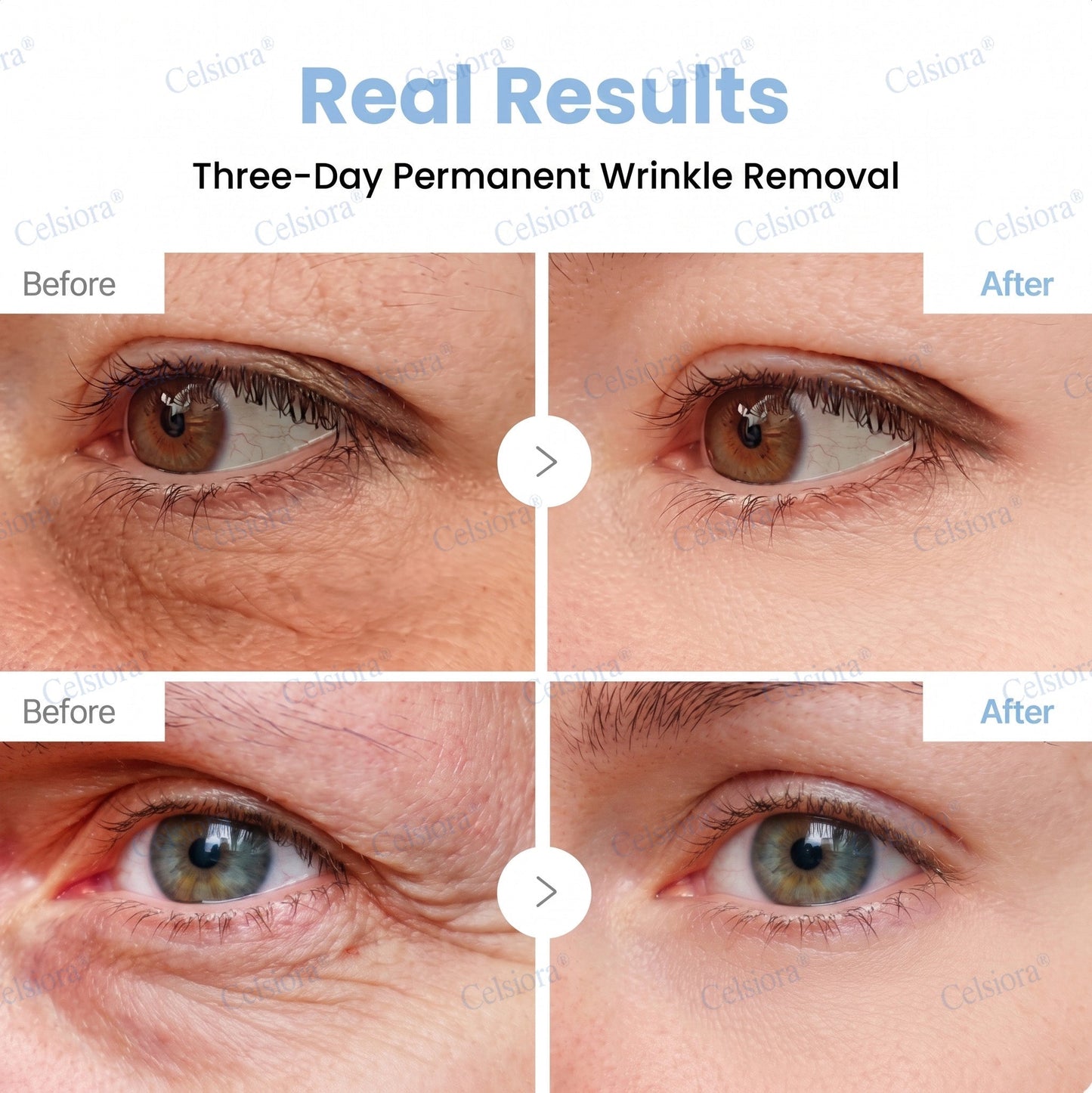 🥈🧡🧶Curalona® Botox & PDRN Anti-Wrinkle Shot – Lift & Firming Cream