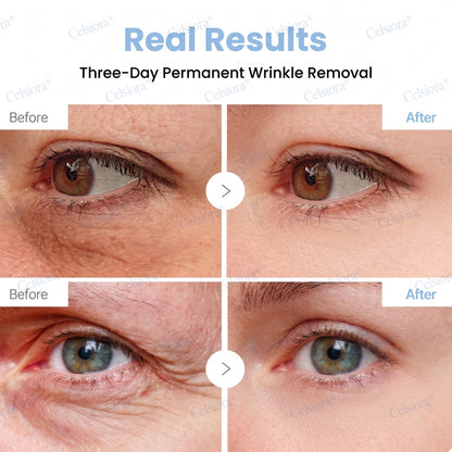 🥈🧡🧶Curalona® Botox & PDRN Anti-Wrinkle Shot – Lift & Firming Cream