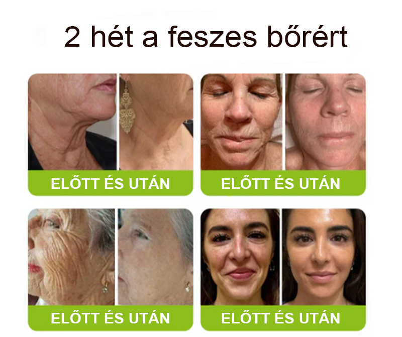 [🔥Utolsó nap 70% kedvezmény] Purelora® Botox és Retinol injekció - Radír mély ráncokra, megereszkedett toka és duzzadt szemek ellen