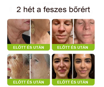 [🔥Utolsó nap 70% kedvezmény] Purelora® Botox és Retinol injekció - Radír mély ráncokra, megereszkedett toka és duzzadt szemek ellen