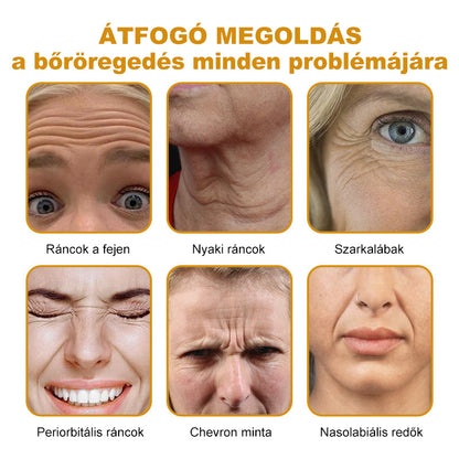 🔥Az akció utolsó napja: 70% kedvezmény - Purelora® Botox méhméreg ránctalanító krém