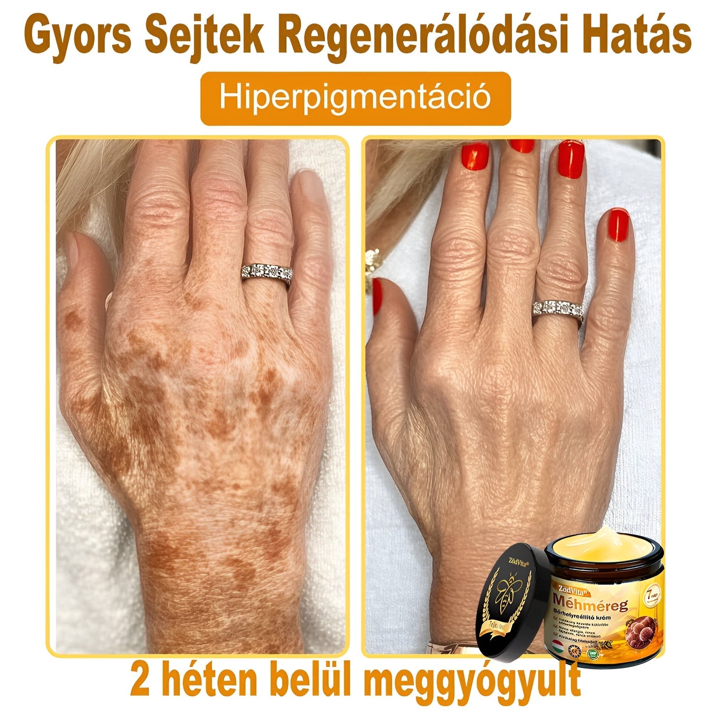 ✨ ZödVita® Méhméreg Bőr Helyreállító Krém 🔥 Természetes Öregedésgátló, Feszesíti a Bőrt, Csökkenti a Ráncokat– 50ml
