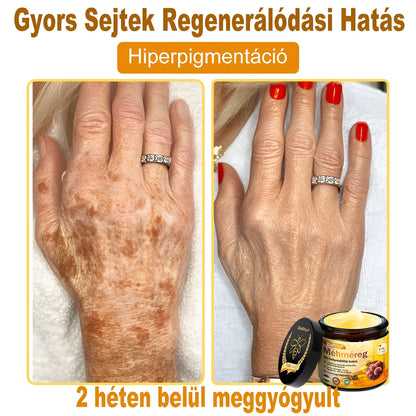 ✨ ZödVita® Méhméreg Bőr Helyreállító Krém 🔥 Természetes Öregedésgátló, Feszesíti a Bőrt, Csökkenti a Ráncokat– 50ml