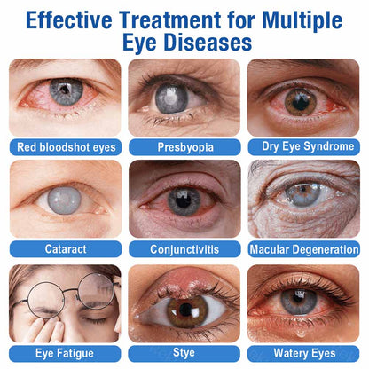 👨‍⚕️𝐏𝐔𝐑𝐄𝐋𝐎𝐑𝐀® LensClarity Eye Drops✅For dry eyes, blurry vision & presbyopia 💦