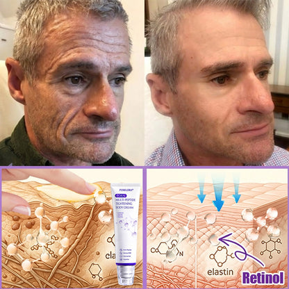 Purelora® 🍅PDRN Multi-Peptide Massaging Body Roller Cream- Anti-aging, Hydrating, Skin Firming & Lifting, Skin Repair, Even Tone, Acne and Dark Spot Treatment, Wart and Mole Removal, and Psoriasis Relief.