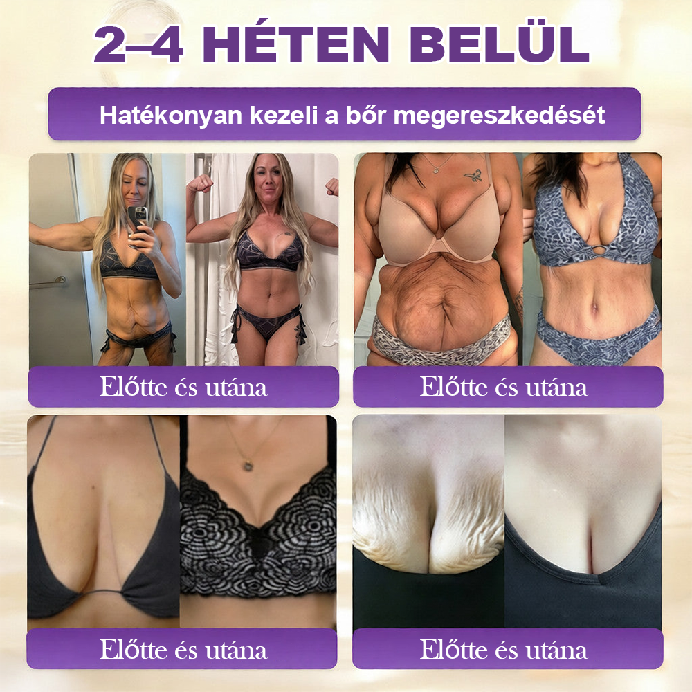 Magyarországról készült és szállított 🍁 Purelora® Biotin Bőrjavító Krém (10 az 1-ben Formula) — Az ajánlat utolsó napja: 25% kedvezmény.