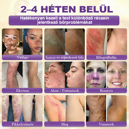 Magyarországról készült és szállított 🍁 Purelora® Biotin Bőrjavító Krém (10 az 1-ben Formula) — Az ajánlat utolsó napja: 25% kedvezmény.