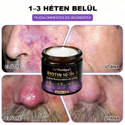 Magyarországról készült és szállított 🍁 Purelora® Biotin Bőrjavító Krém (10 az 1-ben Formula) — Az ajánlat utolsó napja: 25% kedvezmény.