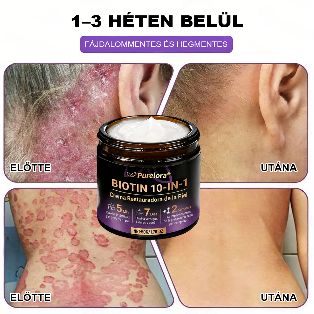 Magyarországról készült és szállított 🍁 Purelora® Biotin Bőrjavító Krém (10 az 1-ben Formula) — Az ajánlat utolsó napja: 25% kedvezmény.