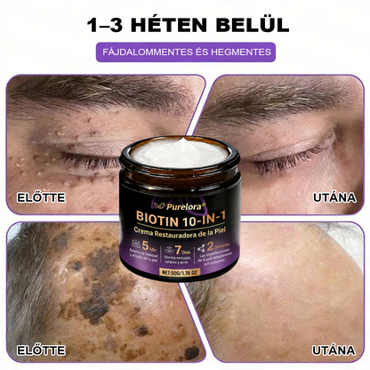 Magyarországról készült és szállított 🍁 Purelora® Biotin Bőrjavító Krém (10 az 1-ben Formula) — Az ajánlat utolsó napja: 25% kedvezmény.