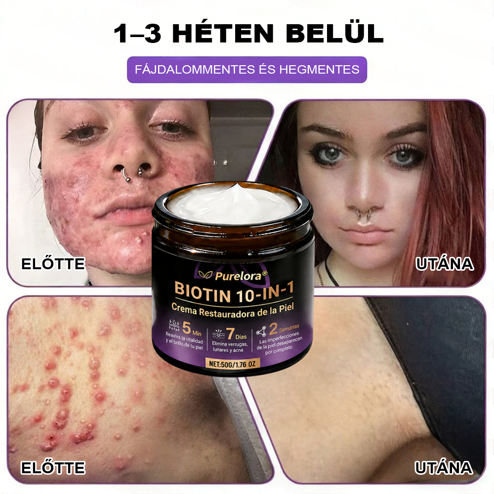Magyarországról készült és szállított 🍁 Purelora® Biotin Bőrjavító Krém (10 az 1-ben Formula) — Az ajánlat utolsó napja: 25% kedvezmény.