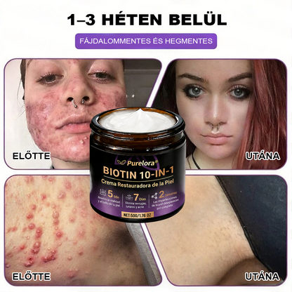 Magyarországról készült és szállított 🍁 Purelora® Biotin Bőrjavító Krém (10 az 1-ben Formula) — Az ajánlat utolsó napja: 25% kedvezmény.