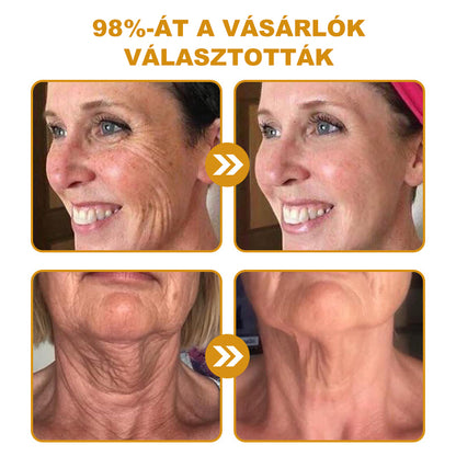 🔥Az akció utolsó napja: 70% kedvezmény - Purelora® Botox méhméreg ránctalanító krém
