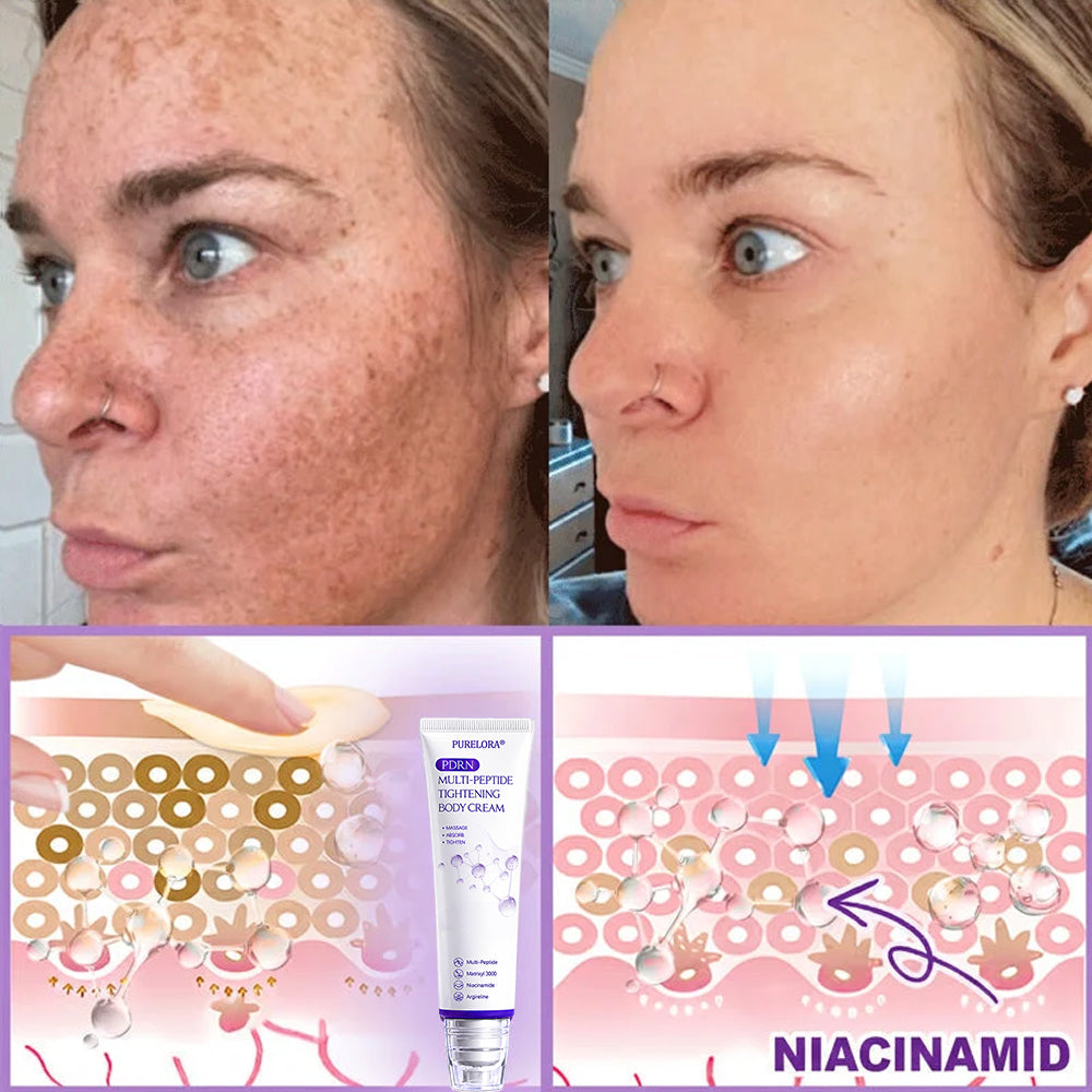 Purelora® 🍅PDRN Multi-Peptide Massaging Body Roller Cream- Anti-aging, Hydrating, Skin Firming & Lifting, Skin Repair, Even Tone, Acne and Dark Spot Treatment, Wart and Mole Removal, and Psoriasis Relief.