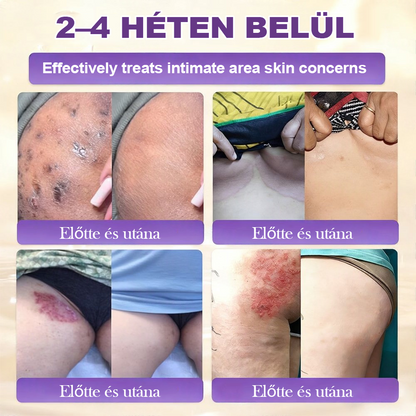Magyarországról készült és szállított 🍁 Purelora® Biotin Bőrjavító Krém (10 az 1-ben Formula) — Az ajánlat utolsó napja: 25% kedvezmény.