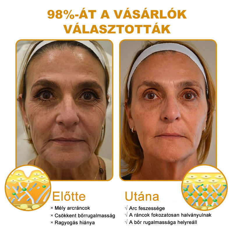 🔥Az akció utolsó napja: 70% kedvezmény - Purelora® Botox méhméreg ránctalanító krém