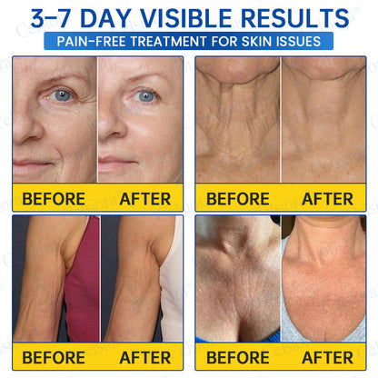 🥈🧡🧶Curalona® Botox & PDRN Anti-Wrinkle Shot – Lift & Firming Cream