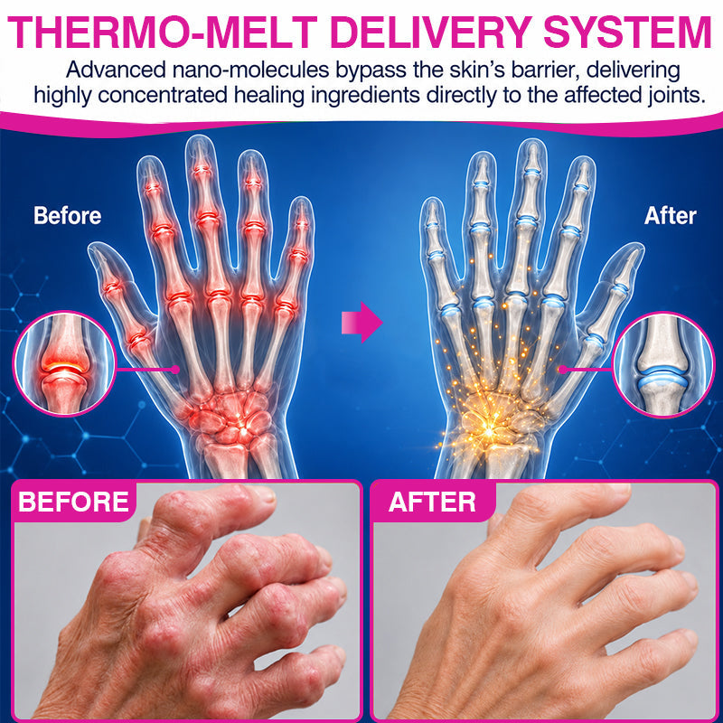 🏅✅🇦🇺 Official Store: 𝐏𝐔𝐑𝐄𝐋𝐎𝐑𝐀® Pain-Relief Bone-Healing Balm Stick(🧑‍⚕️Reducing joint swelling, pain, stiffness, redness, warmth, soreness, and joint fatigue)