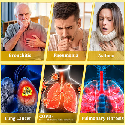 🍀🍀🐝🇦🇺 Official Store:𝐏𝐔𝐑𝐄𝐋𝐎𝐑𝐀®  6-in-1 Herbal BeePropolis Lung Cleanse Spray（👨‍⚕️Directly acts on COPD, asthma, chronic bronchitis (CB), respiratory infections, lung cancer, sinusitis, and other conditions🫁）