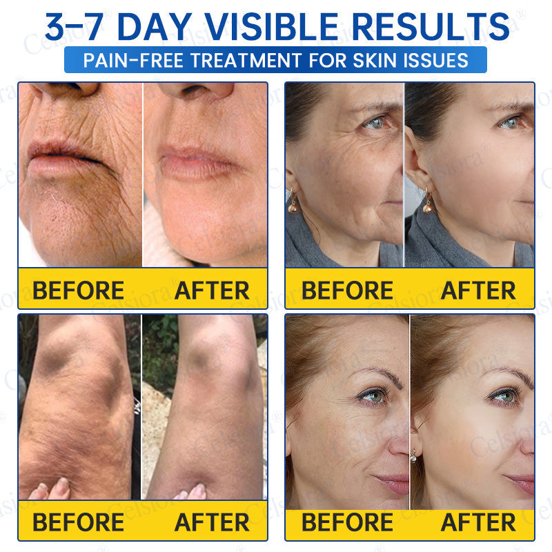 🥈🧡🧶Curalona® Botox & PDRN Anti-Wrinkle Shot – Lift & Firming Cream