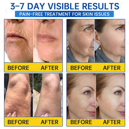 🥈🧡🧶Curalona® Botox & PDRN Anti-Wrinkle Shot – Lift & Firming Cream