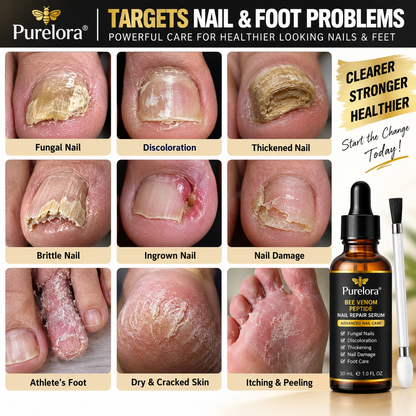 Purelora® Bee Venom Peptide Nail & Foot Repair Serum for nail fungus care, yellow nails, thick nails, and athlete’s foot recovery support.