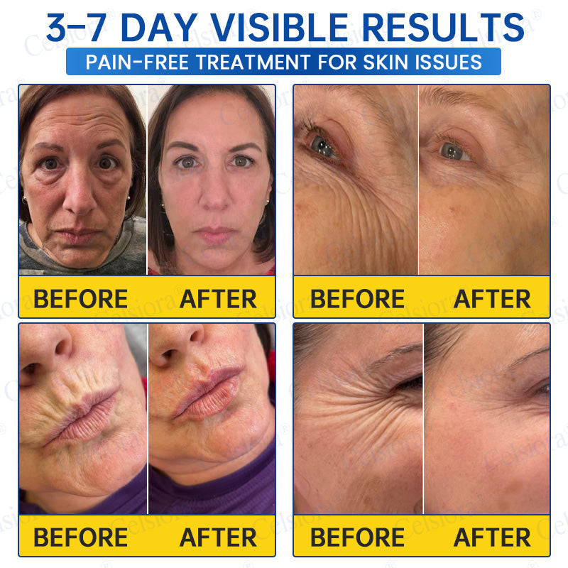 🥈🧡🧶Curalona® Botox & PDRN Anti-Wrinkle Shot – Lift & Firming Cream