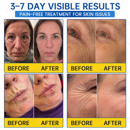 🥈🧡🧶Curalona® Botox & PDRN Anti-Wrinkle Shot – Lift & Firming Cream