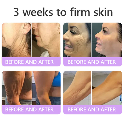 Purelora® 🍅PDRN Multi-Peptide Massaging Body Roller Cream- Anti-aging, Hydrating, Skin Firming & Lifting, Skin Repair, Even Tone, Acne and Dark Spot Treatment, Wart and Mole Removal, and Psoriasis Relief.