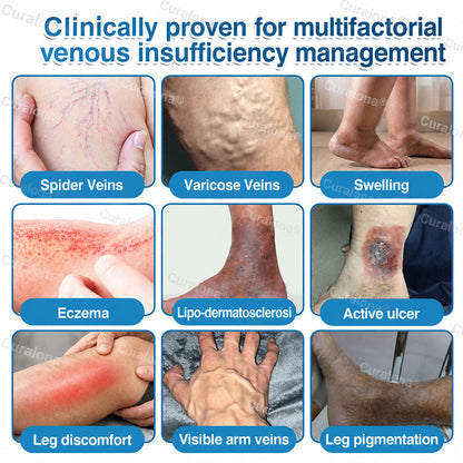 🇬🇧👨‍⚕️✅💙Curalona® VeinRepair Microneedle Patch Roll⚡Instant Relief, Long-Term Results